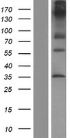 EMR2 (ADGRE2) Human Over-expression Lysate