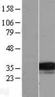 TMEM74 Human Over-expression Lysate