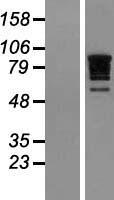 RBM10 Human Over-expression Lysate