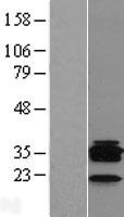 CD20 (MS4A1) Human Over-expression Lysate