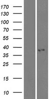 KCTD7 Human Over-expression Lysate