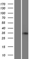 ZNF75A Human Over-expression Lysate