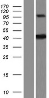 ZDHHC20 Human Over-expression Lysate