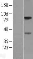SLC29A4 Human Over-expression Lysate