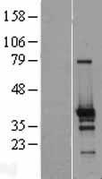 ZNF524 Human Over-expression Lysate