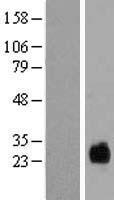 TMEM174 Human Over-expression Lysate