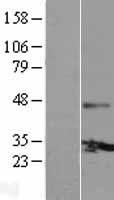 GJB4 Human Over-expression Lysate