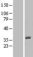 IQCK Human Over-expression Lysate