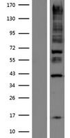 ANKRD15 (KANK1) Human Over-expression Lysate