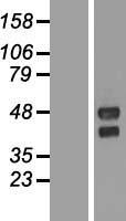 TMEM151A Human Over-expression Lysate
