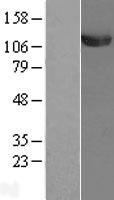 UBA1 Human Over-expression Lysate