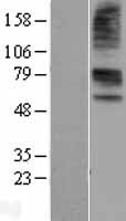 SLC22A6 Human Over-expression Lysate