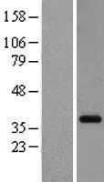 GPR26 Human Over-expression Lysate