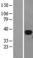 PITX2 Human Over-expression Lysate