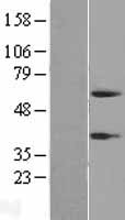 Peptidase inhibitor 16 (PI16) Human Over-expression Lysate