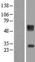 SLC16A11 Human Over-expression Lysate