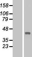 TBC1D21 Human Over-expression Lysate