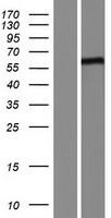FBXL16 Human Over-expression Lysate