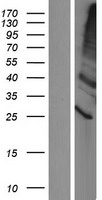 TMEM86A Human Over-expression Lysate