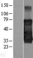 TMEM139 Human Over-expression Lysate