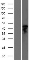 GGT6 Human Over-expression Lysate