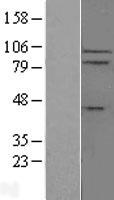 IL17RC Human Over-expression Lysate