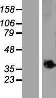 C9ORF91 (TMEM268) Human Over-expression Lysate