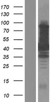 TAB1 Human Over-expression Lysate