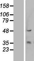 KRT13 Human Over-expression Lysate