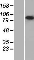 USH1C Human Over-expression Lysate