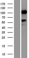 SEMA6D Human Over-expression Lysate