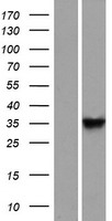 DNAJB13 Human Over-expression Lysate