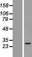 GSTA5 Human Over-expression Lysate