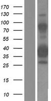 ZNF367 Human Over-expression Lysate