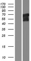 RASGRF1 Human Over-expression Lysate