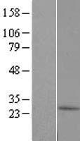 C10orf67 Human Over-expression Lysate