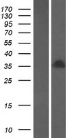 H1oo (H1FOO) Human Over-expression Lysate