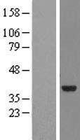 NMNAT2 Human Over-expression Lysate