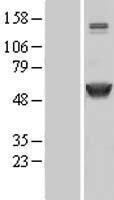 CAMK2A Human Over-expression Lysate