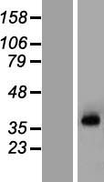 KCNN3 Human Over-expression Lysate
