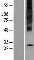 GPR97 (ADGRG3) Human Over-expression Lysate