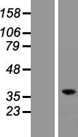 RASSF2 Human Over-expression Lysate