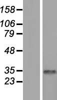 CDYL Human Over-expression Lysate