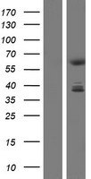 CDYL Human Over-expression Lysate