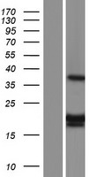 Mitochondrial ribosomal protein L11 (MRPL11) Human Over-expression Lysate