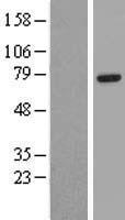 EYA4 Human Over-expression Lysate