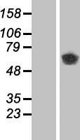 CAMK2B Human Over-expression Lysate