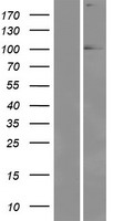 EYA1 Human Over-expression Lysate