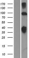 KCNH2 Human Over-expression Lysate