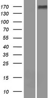 WFDC13 Human Over-expression Lysate